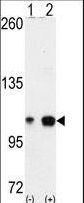 EPHA4 / EPH Receptor A4 Antibody - Western blot of EPHA4 (arrow) using EphA4 Antibody. 293 cell lysates (2 ug/lane) either nontransfected (Lane 1) or transiently transfected with the EPHA4 gene (Lane 2) (Origene Technologies).