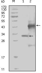 EPHA4 / EPH Receptor A4 Antibody - EphA4 Antibody in Western Blot (WB)