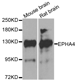 EPHA4 / EPH Receptor A4 Antibody - Western blot analysis of extracts of various cell lines.