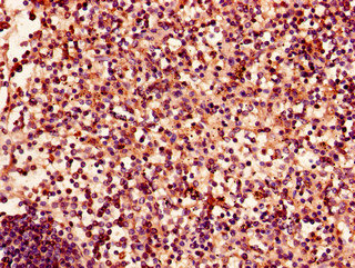 EPHA4 / EPH Receptor A4 Antibody - Immunohistochemistry of paraffin-embedded human spleen tissue using EPHA4 Antibody at dilution of 1:100