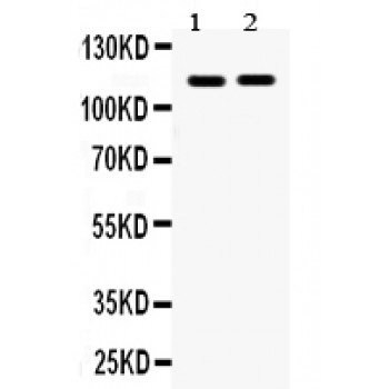 EPHA5 / EPH Receptor A5 Antibody - Eph receptor A5 antibody Western blot. All lanes: Anti Eph receptor A5 at 0.5 ug/ml. Lane 1: Rat Brain Tissue Lysate at 50 ug. Lane 2: Mouse Brain Tissue Lysate at 50 ug. Predicted band size: 114 kD. Observed band size: 114 kD.