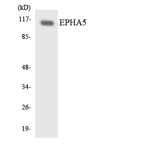 EPHA5 / EPH Receptor A5 Antibody - Western blot analysis of the lysates from HeLa cells using EPHA5 antibody.