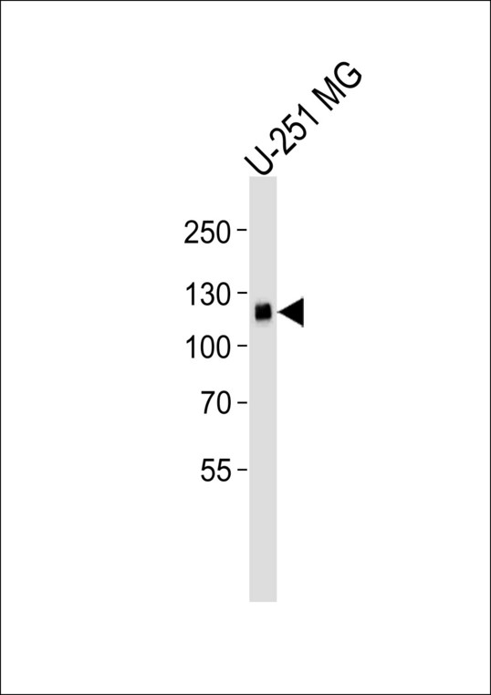 EPHA5 / EPH Receptor A5 Antibody - Western blot of lysate from U-251 MG cell line, using EphA5 Antibody. Antibody was diluted at 1:1000. A goat anti-mouse IgG H&L (HRP) at 1:3000 dilution was used as the secondary antibody. Lysate at 35ug.