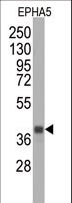 EPHA5 / EPH Receptor A5 Antibody - Western blot of anti-EPHA5 Monoclonal Antibody by EPHA5 recombinant protein (Fragment). EPHA5 (Fragment) protein (arrow) was detected using the purified antibody.(1:2000)