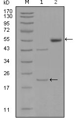 EPHA5 / EPH Receptor A5 Antibody - Western blot using EPHA5 mouse monoclonal antibody against truncated EPHA5-His recombinant protein (1) and truncated EPHA5(aa620-774)-hIgGFc transfected CHO-K1 cell lysate(2).