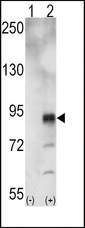 EPHA5 / EPH Receptor A5 Antibody - Western blot of EphA5 (arrow) using rabbit polyclonal EphA5 Antibody. 293 cell lysates (2 ug/lane) either nontransfected (Lane 1) or transiently transfected with the EphA5 gene (Lane 2) (Origene Technologies).