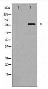 EPHA5 / EPH Receptor A5 Antibody - Western blot of EPHA5 expression in HeLa cell lysate