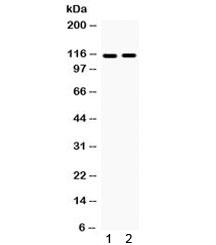EPHA5 / EPH Receptor A5 Antibody