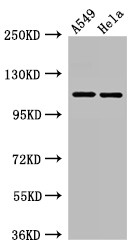 EPHA5 / EPH Receptor A5 Antibody - Positive WB detected in:A549 whole cell lysate,Hela whole cell lysate;All lanes:EPHA5 antibody at 3?g/ml;Secondary;Goat polyclonal to rabbit IgG at 1/50000 dilution;Predicted band size: 115 KDa;Observed band size: 115 KDa;