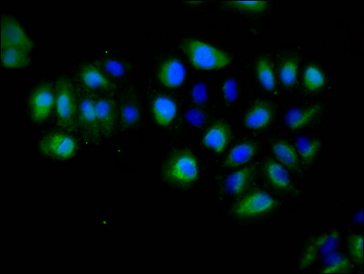 EPHA5 / EPH Receptor A5 Antibody - Immunofluorescent analysis of A549 cells using EPHA5 Antibody at a dilution of 1:100 and Alexa Fluor 488-congugated AffiniPure Goat Anti-Rabbit IgG(H+L)