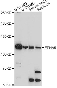 EPHA5 / EPH Receptor A5 Antibody - Western blot analysis of extracts of various cell lines, using EPHA5 antibody at 1:1000 dilution. The secondary antibody used was an HRP Goat Anti-Rabbit IgG (H+L) at 1:10000 dilution. Lysates were loaded 25ug per lane and 3% nonfat dry milk in TBST was used for blocking. An ECL Kit was used for detection and the exposure time was 90s.