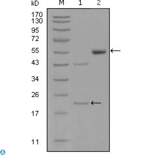 EPHA5 / EPH Receptor A5 Antibody - Western Blot (WB) analysis using EphA5 Monoclonal Antibody against truncated EPHA5-His recombinant protein (1) and truncated EPHA5(aa620-774)-hIgGFc transfected CHO-K1 cell lysate(2).