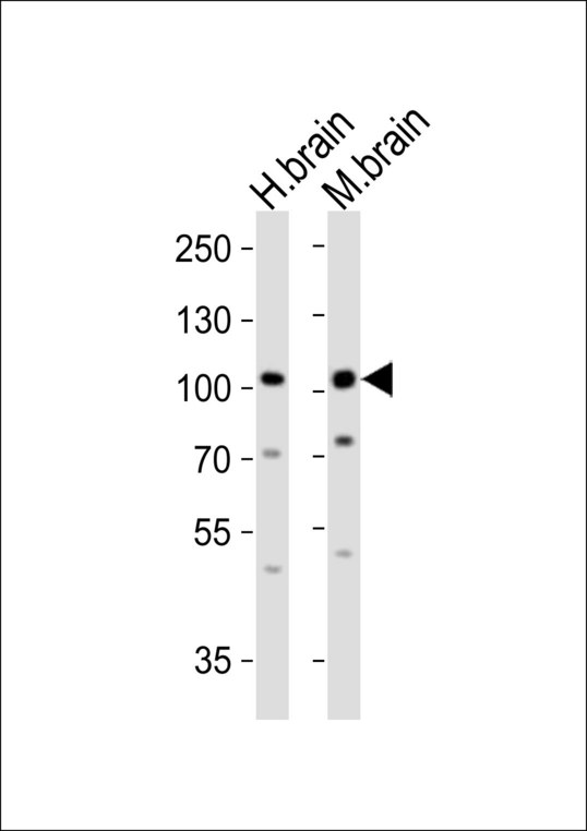 EPHA6 / EPH Receptor A6 Antibody - Western blot of lysates from human brain and mouse brain tissue (from left to right) with Epha6 Antibody. Antibody was diluted at 1:1000 at each lane. A goat anti-rabbit IgG H&L (HRP) at 1:10000 dilution was used as the secondary antibody. Lysates at 20 ug per lane.
