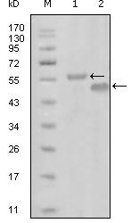 EPHA6 / EPH Receptor A6 Antibody - EphA6 Antibody in Western Blot (WB)