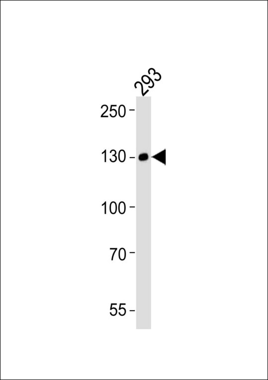 EPHA6 / EPH Receptor A6 Antibody - Western blot of lysate from 293 cell line, using EPHA6 antibody diluted at 1:1000. A goat anti-mouse IgG H&L (HRP) at 1:3000 dilution was used as the secondary antibody. Lysate at 20 ug.
