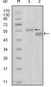 EPHA6 / EPH Receptor A6 Antibody - Western blot using EphA6 mouse monoclonal antibody against truncated MBP-EphA6 recombinant protein (1) and truncated GST-EphA6(aa695-795) recombinant protein (2).