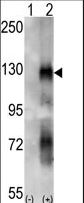 EPHA6 / EPH Receptor A6 Antibody - Western blot of EphA6 (arrow) using rabbit polyclonal EphA6 Antibody. 293 cell lysates (2 ug/lane) either nontransfected (Lane 1) or transiently transfected with the EPHA6 gene (Lane 2) (Origene Technologies).