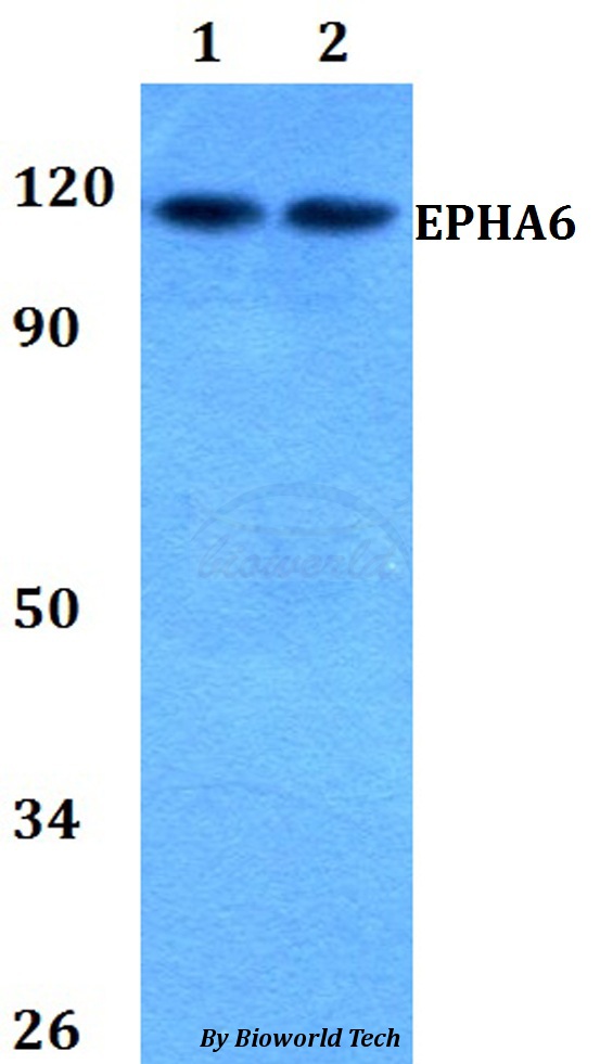 EPHA6 / EPH Receptor A6 Antibody - Western blot of EPHA6 antibody at 1:500 dilution. Lane 1: A549 whole cell lysate. Lane 2: sp2/0 whole cell lysate.