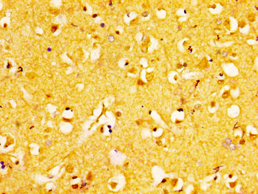 EPHA6 / EPH Receptor A6 Antibody - Immunohistochemistry image at a dilution of 1:200 and staining in paraffin-embedded human brain tissue performed on a Leica BondTM system. After dewaxing and hydration, antigen retrieval was mediated by high pressure in a citrate buffer (pH 6.0) . Section was blocked with 10% normal goat serum 30min at RT. Then primary antibody (1% BSA) was incubated at 4 °C overnight. The primary is detected by a biotinylated secondary antibody and visualized using an HRP conjugated SP system.