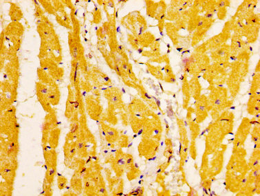 EPHA6 / EPH Receptor A6 Antibody - Immunohistochemistry image at a dilution of 1:200 and staining in paraffin-embedded human heart tissue performed on a Leica BondTM system. After dewaxing and hydration, antigen retrieval was mediated by high pressure in a citrate buffer (pH 6.0) . Section was blocked with 10% normal goat serum 30min at RT. Then primary antibody (1% BSA) was incubated at 4 °C overnight. The primary is detected by a biotinylated secondary antibody and visualized using an HRP conjugated SP system.