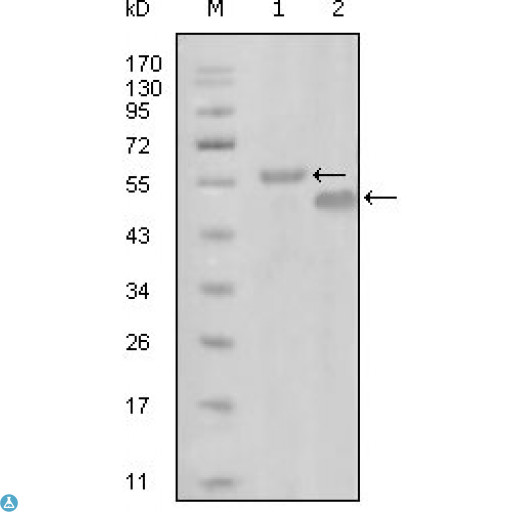 EPHA6 / EPH Receptor A6 Antibody - Western Blot (WB) analysis using EphA6 Monoclonal Antibody against truncated MBP-EphA6 recombinant protein (1) and truncated GST-EphA6(aa695-795) recombinant protein (2).
