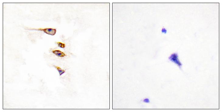 EPHA6 / EPH Receptor A6 Antibody - Peptide - + Immunohistochemistry analysis of paraffin-embedded human brain tissue, using EPHA6 antibody.
