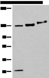 EPHA6 / EPH Receptor A6 Antibody - Western blot analysis of 293T cell Mouse brain tissue lysates  using EPHA6 Polyclonal Antibody at dilution of 1:500