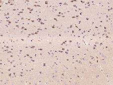 EPHA6 / EPH Receptor A6 Antibody - Immunochemical staining of mouse EphA6 in mouse brain with rabbit polyclonal antibody at 1:1000 dilution, formalin-fixed paraffin embedded sections.