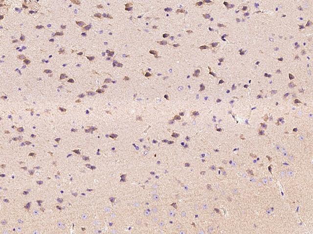 EPHA6 / EPH Receptor A6 Antibody - Immunochemical staining of mouse EphA6 in mouse brain with rabbit polyclonal antibody at 1:1000 dilution, formalin-fixed paraffin embedded sections.