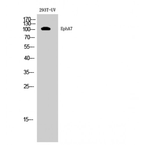 EPHA7 / EPH Receptor A7 Antibody - Western blot of EphA7 antibody