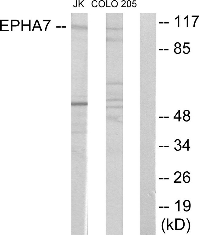 EPHA7 / EPH Receptor A7 Antibody - Western blot analysis of lysates from Jurkat cells and COLO205 cells, using EPHA7 Antibody. The lane on the right is blocked with the synthesized peptide.
