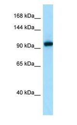 EPHA7 / EPH Receptor A7 Antibody - EPHA7 antibody Western Blot of OVCAR-3.  This image was taken for the unconjugated form of this product. Other forms have not been tested.