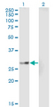 EPHA7 / EPH Receptor A7 Antibody - Western Blot analysis of EPHA7 expression in transfected 293T cell line by EPHA7 monoclonal antibody (M01A), clone 1G11.Lane 1: EPHA7 transfected lysate (Predicted MW: 31.8 KDa).Lane 2: Non-transfected lysate.