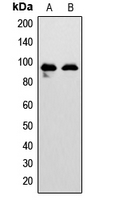 EPHA7 / EPH Receptor A7 Antibody - Western blot analysis of EPHA7 expression in HEK293T (A); Jurkat (B) whole cell lysates.