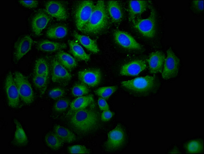 EPHA7 / EPH Receptor A7 Antibody - Immunofluorescence staining of A549 cells with EPHA7 Antibody at 1:400, counter-stained with DAPI. The cells were fixed in 4% formaldehyde, permeabilized using 0.2% Triton X-100 and blocked in 10% normal Goat Serum. The cells were then incubated with the antibody overnight at 4°C. The secondary antibody was Alexa Fluor 488-congugated AffiniPure Goat Anti-Rabbit IgG(H+L).
