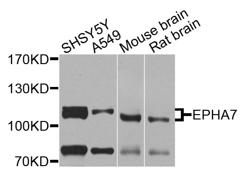 EPHA7 / EPH Receptor A7 Antibody - Western blot analysis of extracts of various cells.