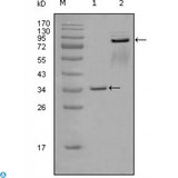 EPHA7 / EPH Receptor A7 Antibody - Immunohistochemistry (IHC) analysis of paraffin-embedded Human Breast tissues with AEC staining using EphA7 Monoclonal Antibody.