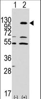 EPHA7 / EPH Receptor A7 Antibody - Western blot of EphA7 (arrow) using rabbit polyclonal EphA7 Antibody. 293 cell lysates (2 ug/lane) either nontransfected (Lane 1) or transiently transfected with the EphA7 gene (Lane 2) (Origene Technologies).