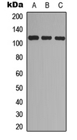 EPHA7 / EPH Receptor A7 Antibody - Western blot analysis of EPHA7 (pY608) expression in A549 (A); NS-1 (B); PC12 (C) whole cell lysates.
