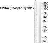 EPHA7 / EPH Receptor A7 Antibody - Western blot analysis of extracts from JurKat cells, using EPHA7 (Phospho-Tyr791) antibody.