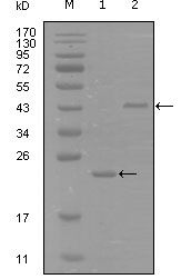 EPHA8 / EPH Receptor A8 Antibody - Western blot of EphA8 mouse mAb against truncated Trx-EphA8 recombinant protein (1) and truncated MBP-EphA8(aa70-150) recombinant protein (2).