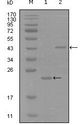 EPHA8 / EPH Receptor A8 Antibody - Western blot of EphA8 mouse mAb against truncated Trx-EphA8 recombinant protein (1) and truncated MBP-EphA8(aa70-150) recombinant protein (2).