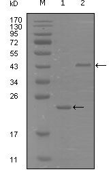 EPHA8 / EPH Receptor A8 Antibody - EphA8 Antibody in Western Blot (WB)