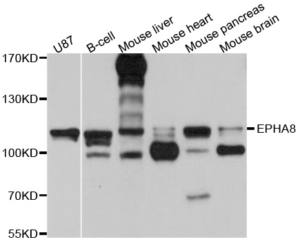 EPHA8 / EPH Receptor A8 Antibody - Western blot analysis of extracts of various cell lines, using EPHA8 antibody at 1:1000 dilution. The secondary antibody used was an HRP Goat Anti-Rabbit IgG (H+L) at 1:10000 dilution. Lysates were loaded 25ug per lane and 3% nonfat dry milk in TBST was used for blocking. An ECL Kit was used for detection and the exposure time was 15s.
