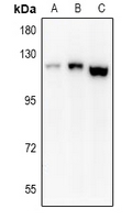 EPHA8 / EPH Receptor A8 Antibody - Western blot analysis of EPHA8 expression in rat heart (A), mouse spleen (B), Hela (C) whole cell lysates.