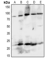 EPHA8 / EPH Receptor A8 Antibody - Western blot analysis of EPHA8 expression in Hela (A), Jurkat (B), NIH3T3 (C), H9C2 (D), PC12 (E) whole cell lysates.