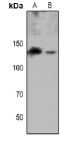 EPHA8 / EPH Receptor A8 Antibody - Western blot analysis of EPHA8 (pY615) expression in NIH3T3 (A), H9C2 (B) whole cell lysates.