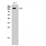 EPHB1 / EPH Receptor B1 Antibody - Western blot of EphB1 antibody