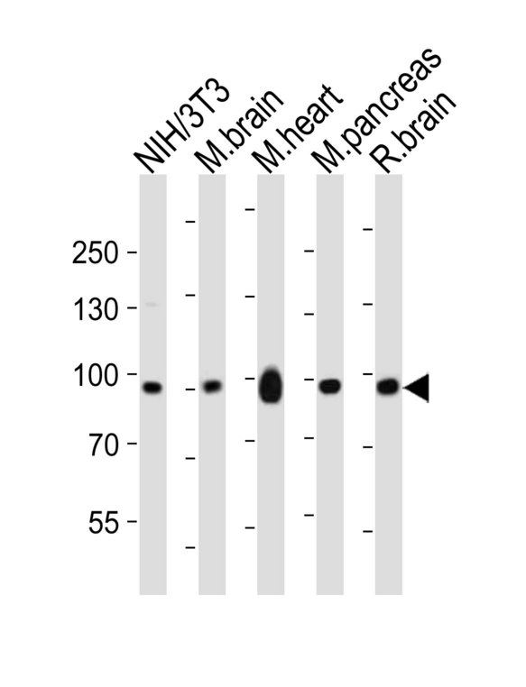 EPHB1 / EPH Receptor B1 Antibody - Western blot of lysates from mouse NIH/3T3 cell line, mouse brain, mouse heart, mouse pancreas, rat brain tissue (from left to right) with Ephb1 Antibody. Antibody was diluted at 1:1000 at each lane. A goat anti-rabbit IgG H&L (HRP) at 1:10000 dilution was used as the secondary antibody. Lysates at 20 ug per lane.
