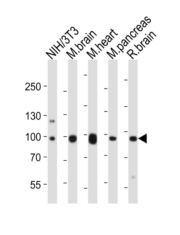 EPHB1 / EPH Receptor B1 Antibody - Western blot of lysates from mouse NIH/3T3 cell line, mouse brain, mouse heart, mouse pancreas, rat brain tissue lysate (from left to right) with Ephb1 Antibody. Antibody was diluted at 1:1000 at each lane. A goat anti-rabbit IgG H&L (HRP) at 1:10000 dilution was used as the secondary antibody. Lysates at 20 ug per lane.